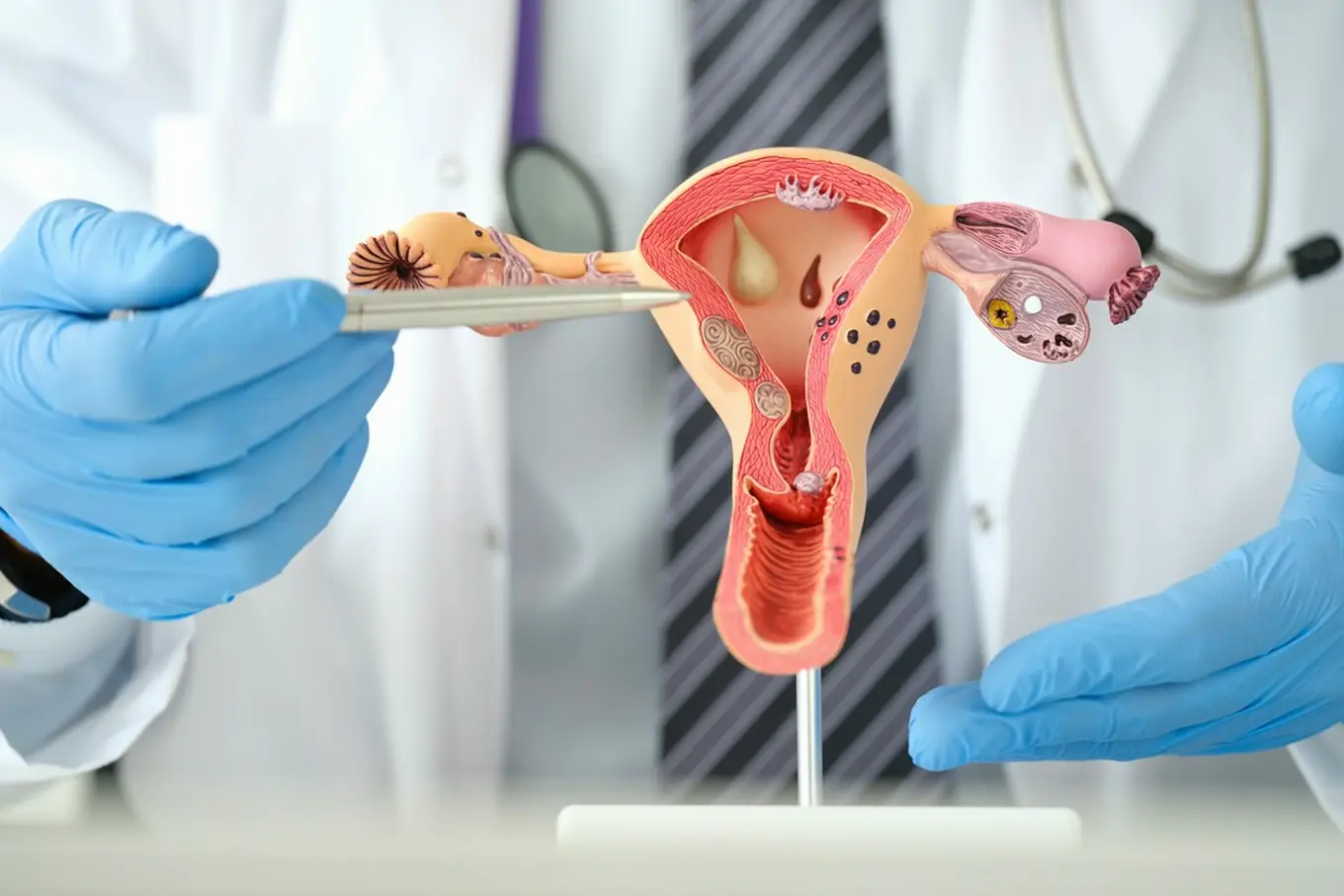 ginekolog pokazujący model narządów damskich